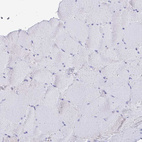 Immunohistochemical staining of human skeletal muscle shows negative membranous positivity in myocytes as expected.