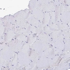 Immunohistochemical staining of human skeletal muscle shows negative membranous positivity in myocytes as expected.