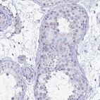 Immunohistochemical staining of human testis shows negative membranous positivity in cells in seminiferous ducts as expected.