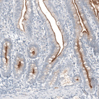 Anti-TMPRSS2 Antibody