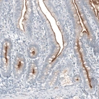 Immunohistochemical staining of human duodenum shows strong membranous positivity in glandular cells.