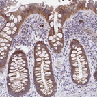 Immunohistochemical staining of human rectum shows moderate cytoplasmic positivity in glandular cells.