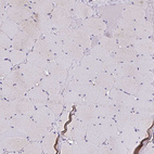 Immunohistochemical staining of human skeletal muscle shows no positivity in myocytes as expected.