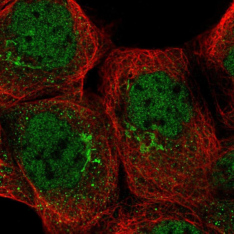 Anti-TRRAP Antibody