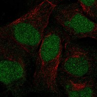 Anti-ANKRD20A3P Antibody