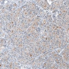 Immunohistochemical staining of human pancreas shows moderate membranous positivity in exocrine glandular cells.
