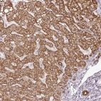 Anti-PQLC2L Antibody