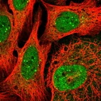 Immunofluorescent staining of human cell line U-2 OS shows localization to nucleoplasm, nuclear bodies & the Golgi apparatus.
