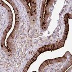 Immunohistochemical staining of human Fallopian tube shows moderate to strong positivity in glandular cells.