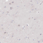 Immunohistochemical staining of human cerebral cortex shows no positivity in neurons as expected.