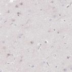 Immunohistochemical staining of human cerebral cortex shows no positivity in neurons as expected.