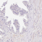 Immunohistochemical staining of human prostate shows no positivity in glandular cells as expected.