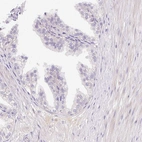 Immunohistochemical staining of human prostate shows no positivity in glandular cells as expected.