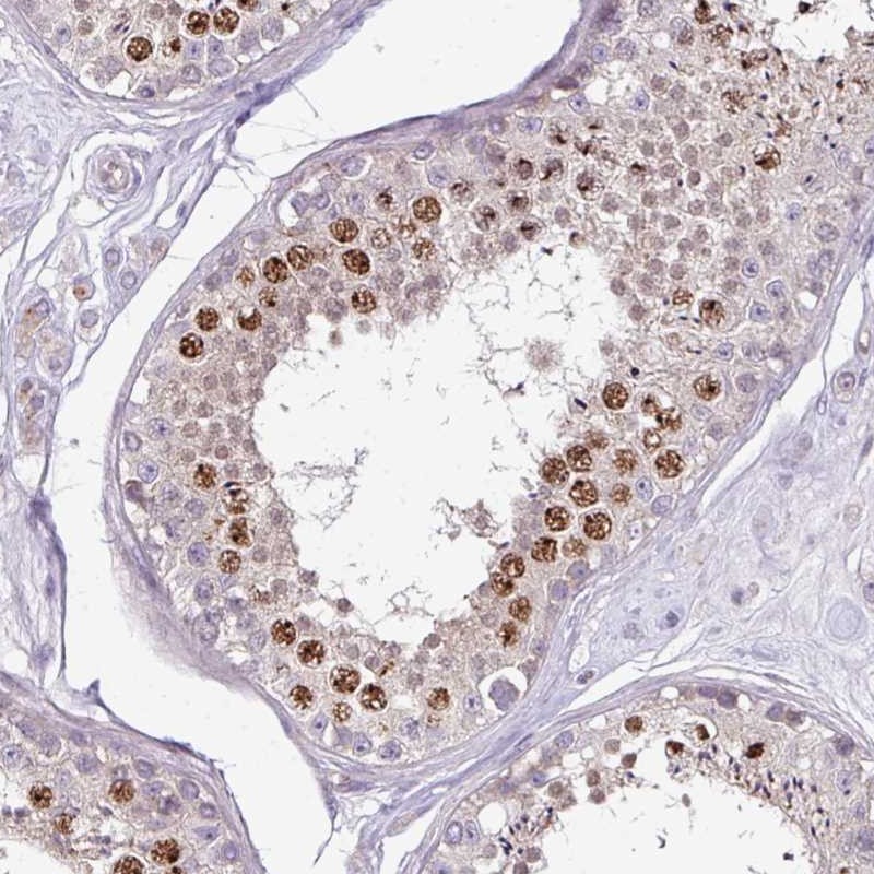 Anti-C19orf33 Antibody
