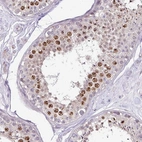 Anti-C19orf33 Antibody