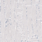 Immunohistochemical staining of human skeletal muscle shows no positivity in myocytes as expected.