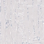 Immunohistochemical staining of human skeletal muscle shows no positivity in myocytes as expected.