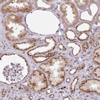 Anti-CCDC85B Antibody