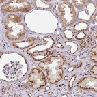 Anti-CCDC85B Antibody