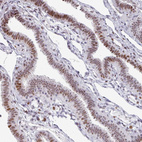 Anti-SF3B5 Antibody