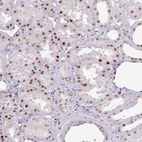 Immunohistochemical staining of human kidney shows moderate nuclear positivity in cells in tubules.