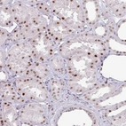 Immunohistochemical staining of human kidney shows moderate nuclear positivity in cells in tubules.