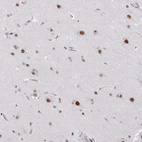 Immunohistochemical staining of human cerebral cortex shows strong nuclear positivity in neuronal cells.