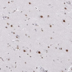 Immunohistochemical staining of human cerebral cortex shows strong nuclear positivity in neuronal cells.