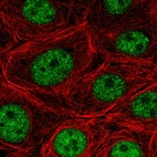 Immunofluorescent staining of human cell line MCF7 shows localization to nucleoplasm.