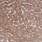 Anti-SKIV2L Antibody