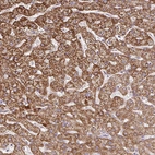 Anti-SKIV2L Antibody