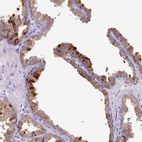 Immunohistochemical staining of human prostate shows moderate cytoplasmic positivity in glandular cells.