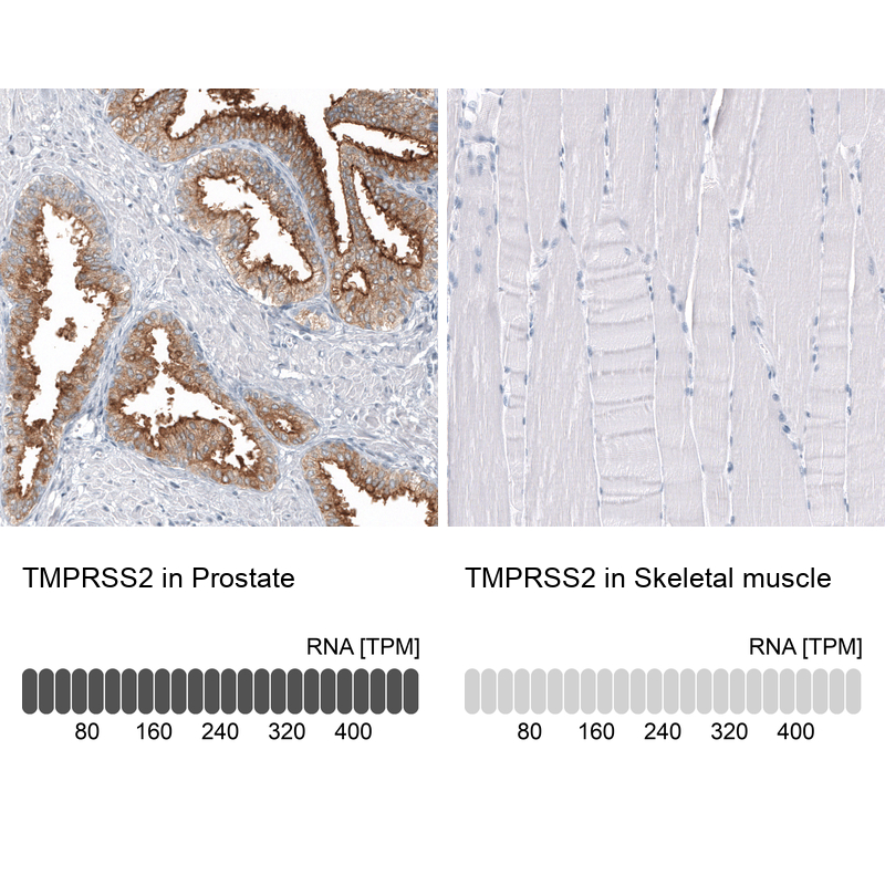 Anti-TMPRSS2 Antibody