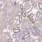 Immunohistochemical staining of human kidney shows moderate cytoplasmic positivity in cells in tubules.