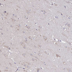Immunohistochemical staining of human cerebral cortex shows no cytoplasmic positivity in neuronal cells.
