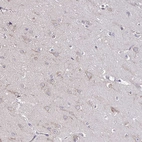 Immunohistochemical staining of human cerebral cortex shows no cytoplasmic positivity in neuronal cells.