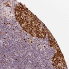 Immunohistochemical staining of human lymph node shows strong nuclear positivity in germinal center cells.