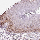 Immunohistochemical staining of human skin shows moderate nuclear positivity in squamous epithelial cells.