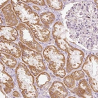 Immunohistochemical staining of human kidney shows moderate cytoplasmic positivity in cells in tubules.