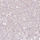 Immunohistochemical staining of human liver shows no nuclear positivity in hepatocytes as expected.