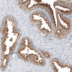 Anti-TMPRSS2 Antibody