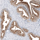 Immunohistochemical staining of human prostate shows strong membranous positivity in glandular cells.
