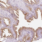 Anti-TMC8 Antibody