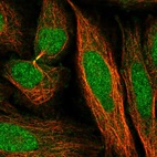 Immunofluorescent staining of human cell line SiHa shows localization to nucleoplasm, cytosol & cytokinetic bridge.