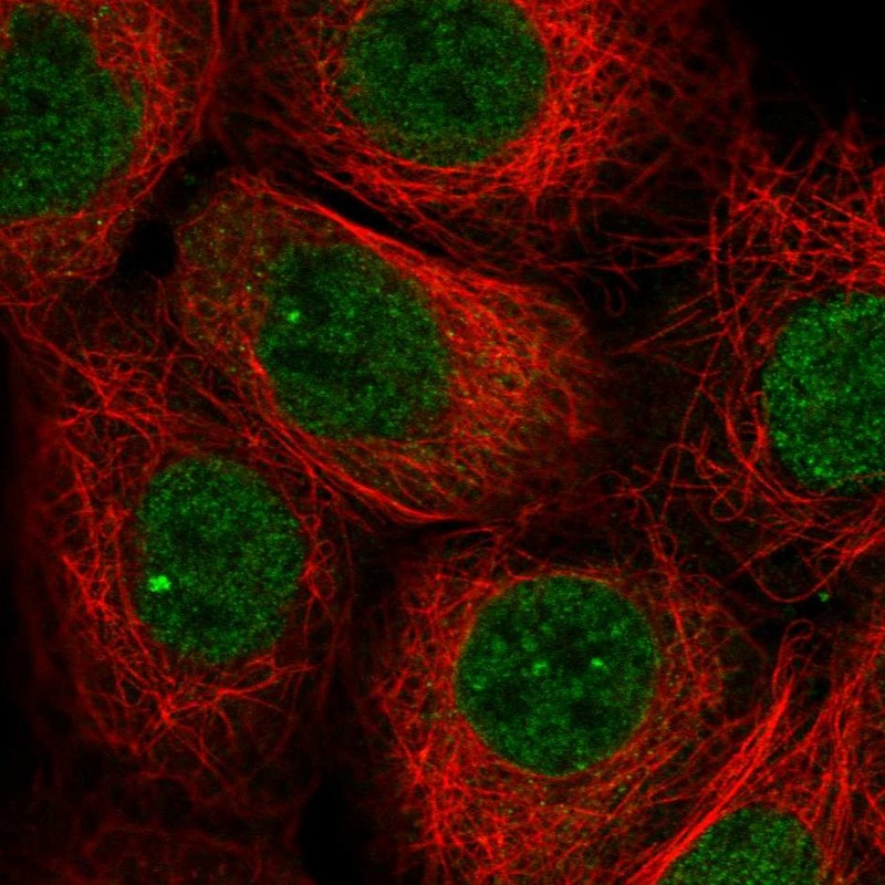 Anti-TNFAIP8 Antibody