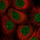 Anti-TNFAIP8 Antibody