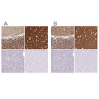 Immunohistochemical staining of human cerebellum, cerebral cortex, pancreas and skeletal muscle using Anti-SIRPA antibody HPA054437 (A) shows similar protein distribution across tissues to independent antibody HPA058511 (B).