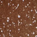 Immunohistochemical staining of human cerebral cortex shows strong positivity in neuropil.