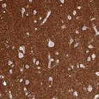 Immunohistochemical staining of human cerebral cortex shows strong positivity in neuropil.