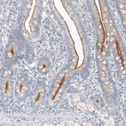 Immunohistochemical staining of human duodenum shows strong membranous positivity in glandular cells.